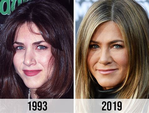 Does Jennifer Aniston Have Plastic Surgery? Exploring the Rumors and Realities