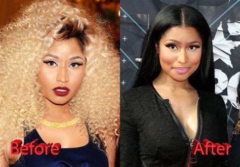 Does Nicki Minaj Have Plastic Surgery? Exploring the Intersection of Beauty Standards and Celebrity Culture