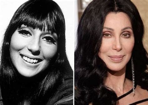 Who is Cher's Plastic Surgeon and Why Does It Matter in the Age of Eternal Youth?